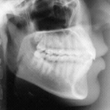 Radiologia Odontológica no Jardim América